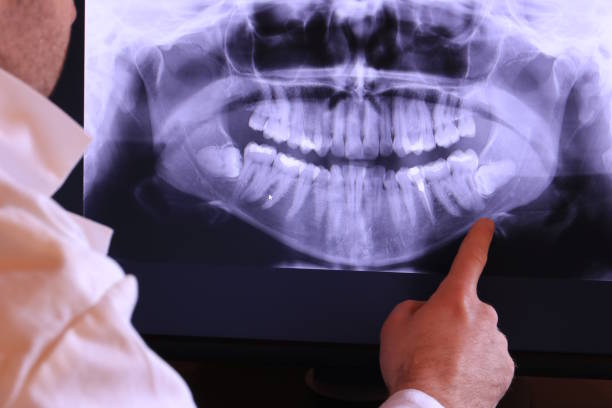 Best Dentist for Severe Toothache  in Berlin, NH