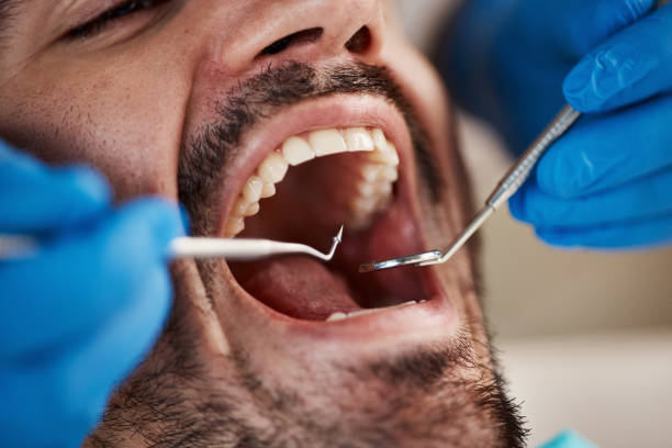 Best Broken Tooth Emergency  in Berlin, NH